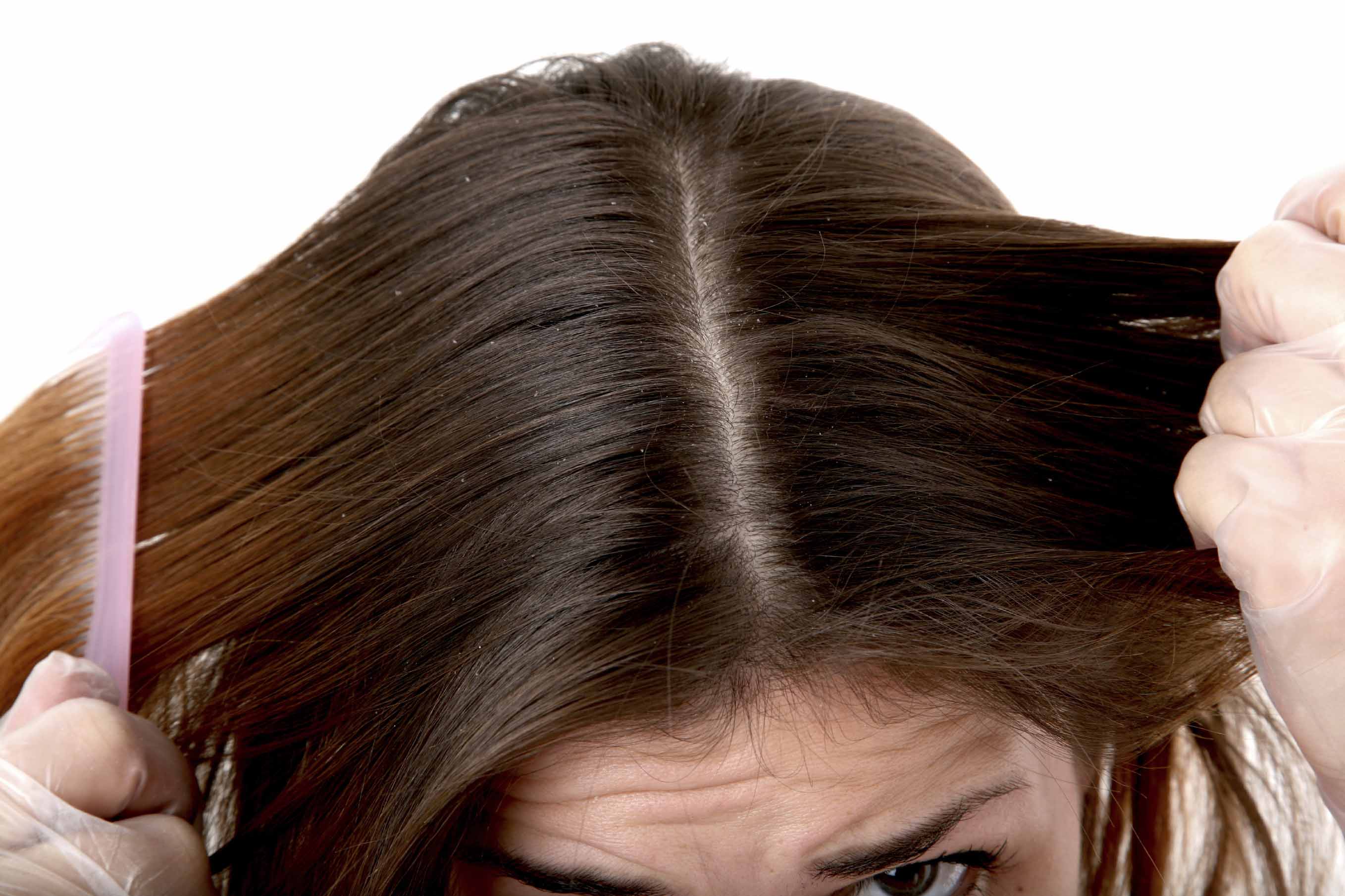 Brunette Hair Scalp