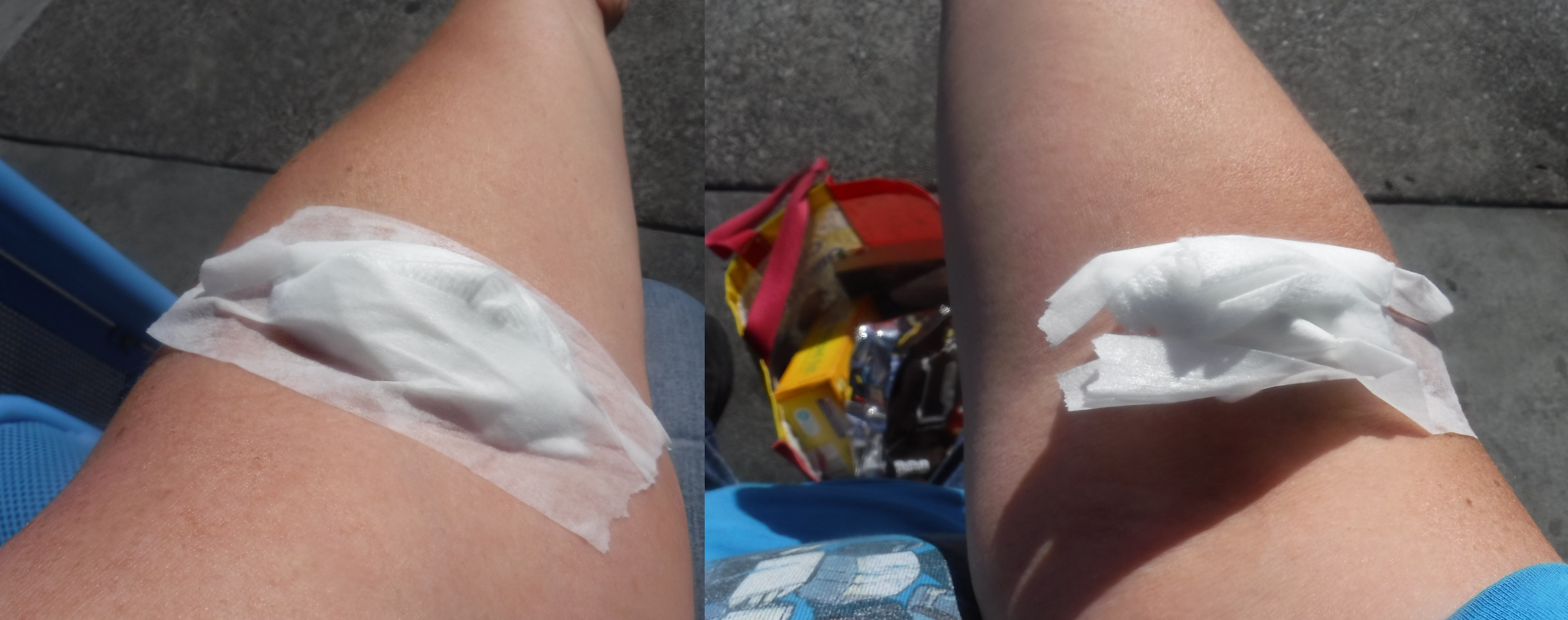 Photos I took of both my arms at the bus stop Photos I took of both my arms at the bus stop