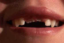 Smile~ - All I want for Christmas is my 2 front teeth!