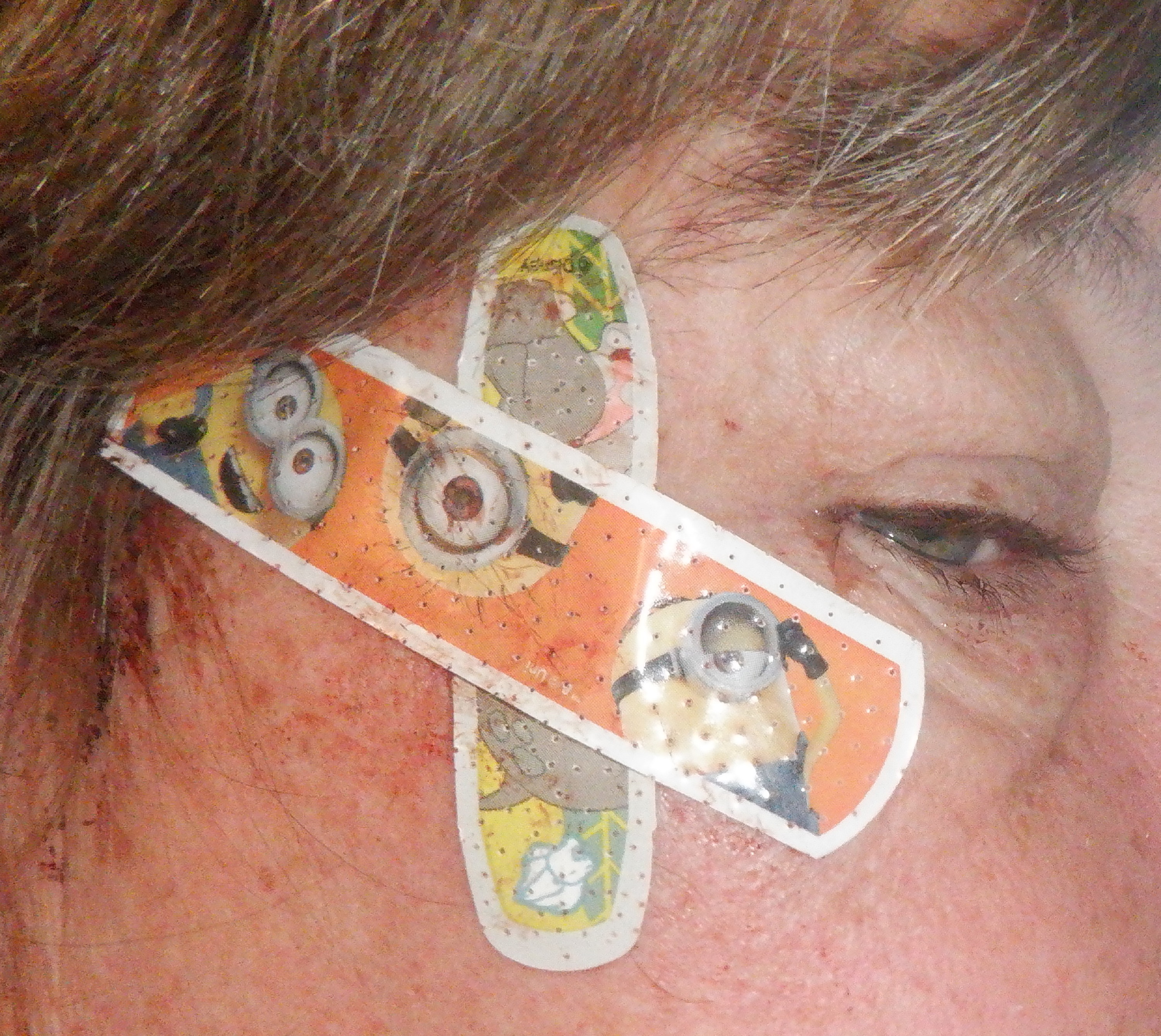 Photo I took of my goofy band aids Photo I took of my goofy band aids