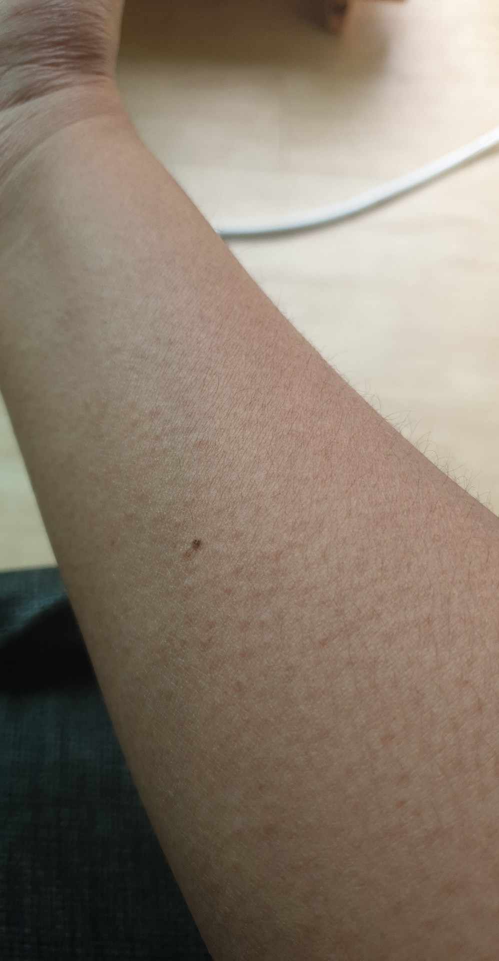 skin rash