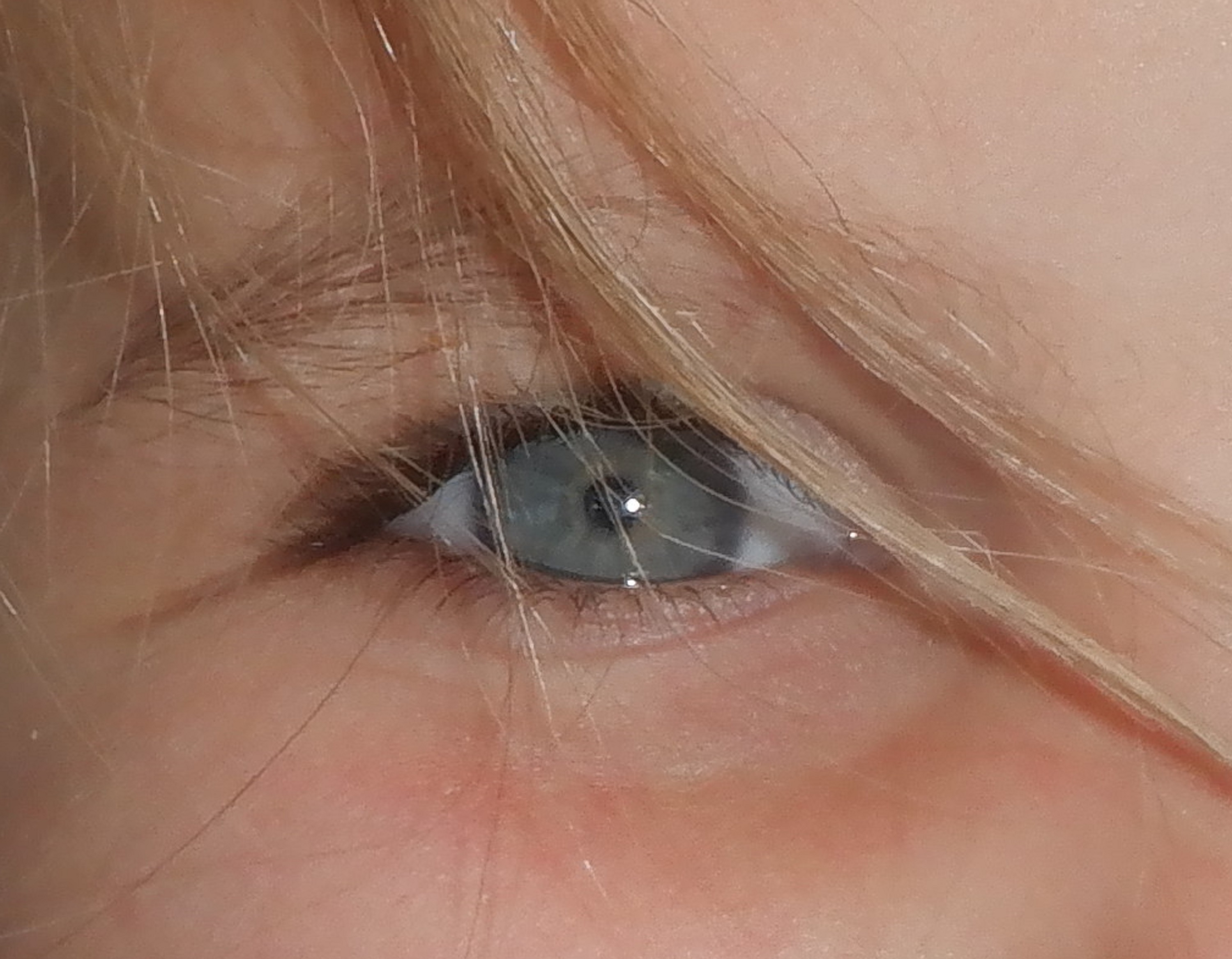 Eye of one of my kids 