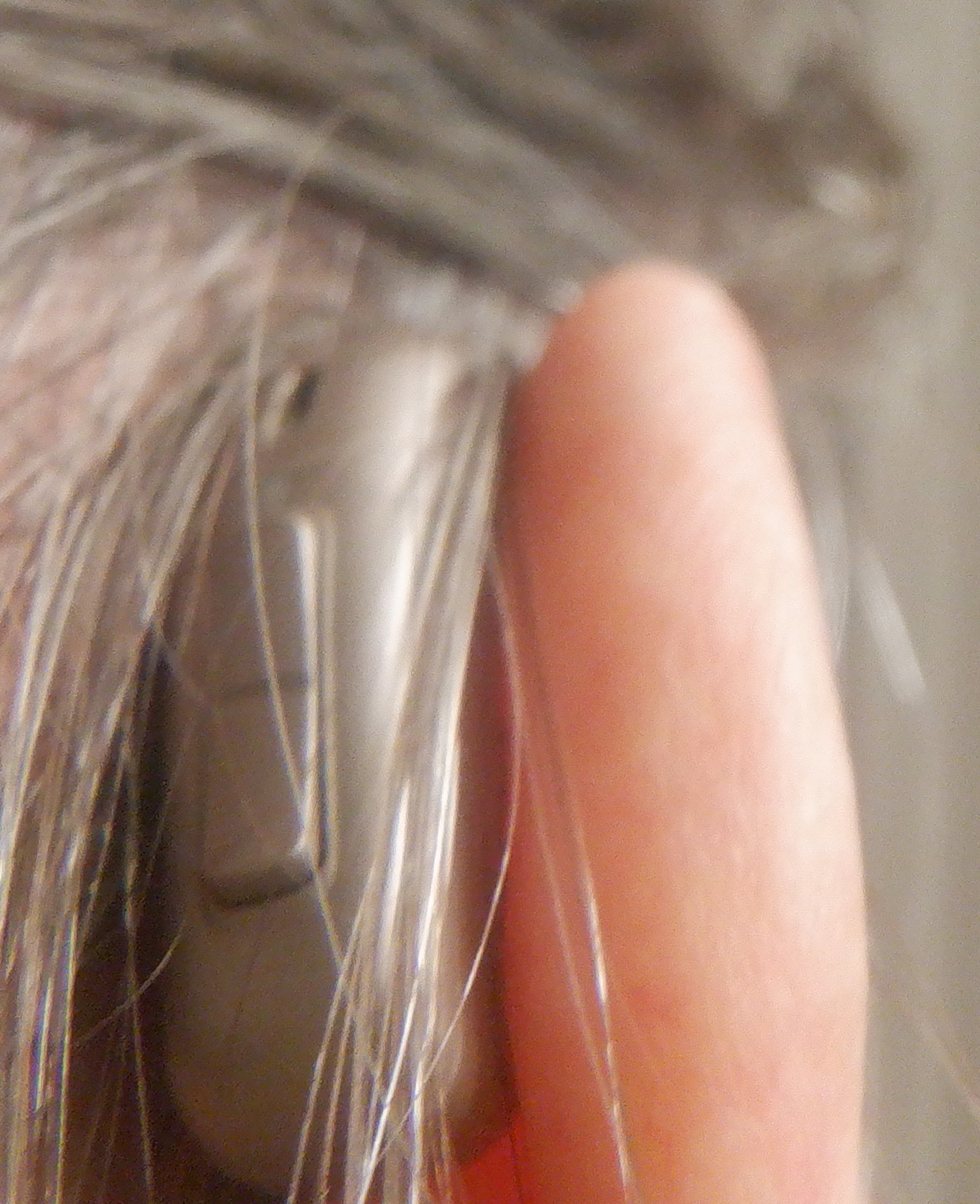 Photo I tried to take of the hearing aid at the back of my ear. 