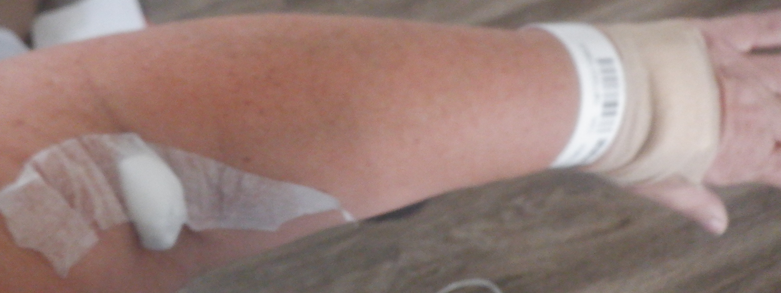 Photo I took of my arm with the ID bracelet and bandages from IVs, etc. Photo I took of my arm with the ID bracelet and bandages from IVs, etc.