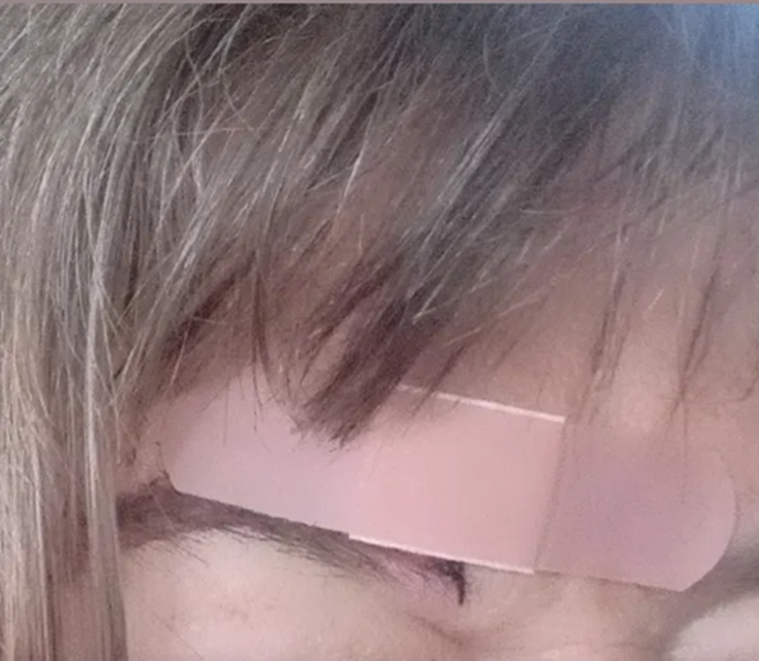Photo I took of my bandaged owie