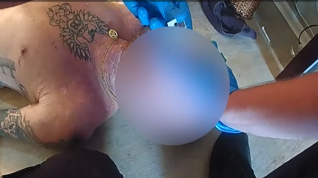 A Lee County Florida being rescued by police after an overdose