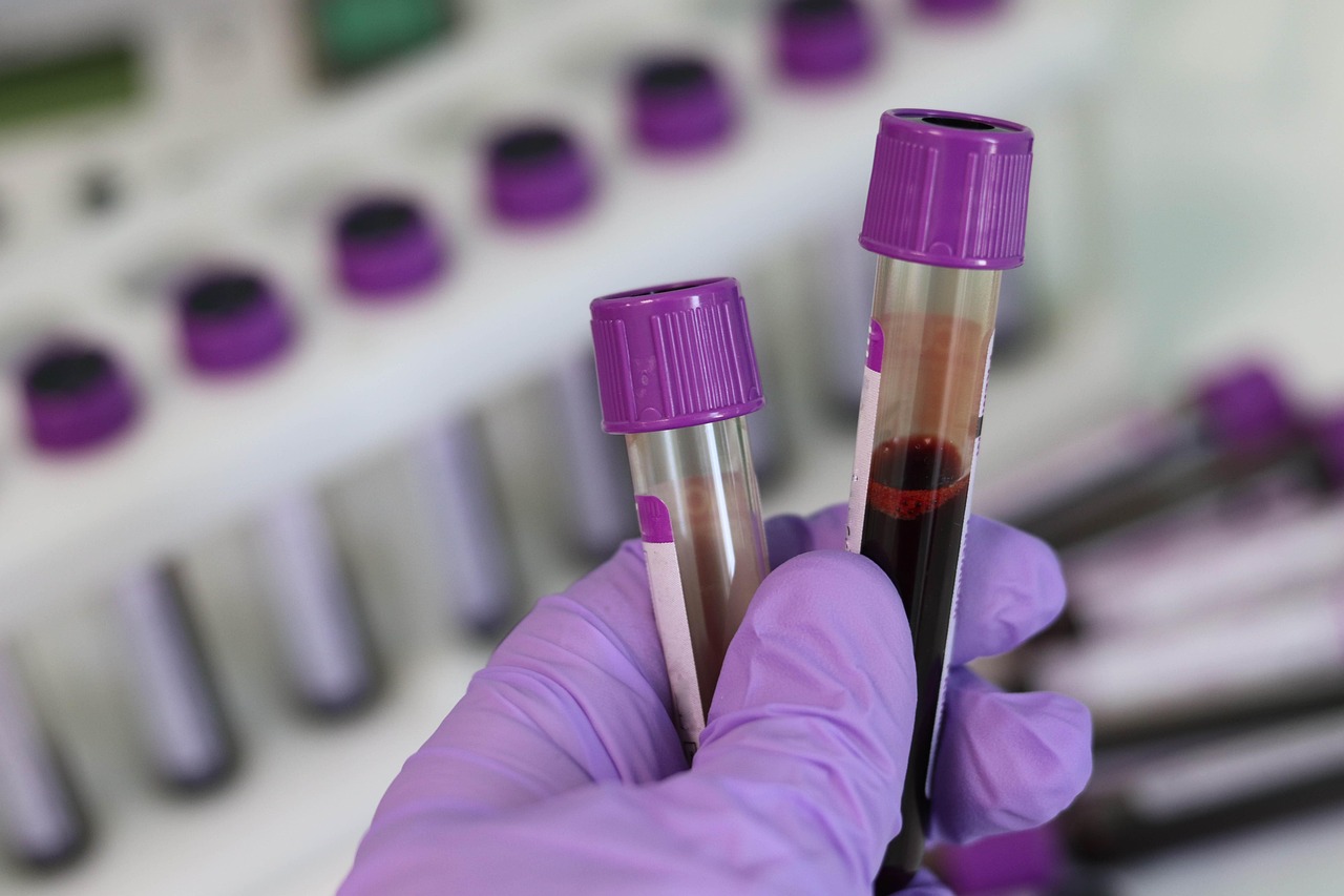 https://pixabay.com/photos/laboratory-medical-medicine-hand-3827736/ https://pixabay.com/photos/laboratory-medical-medicine-hand-3827736/