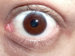human eye - eye of an human....blue i think
