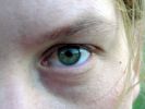 Eye - Blinking eyes makes them rest