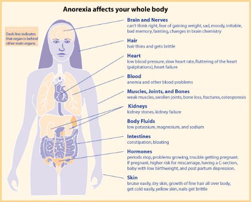 Anorexia affects the whole body. - Anorxia health chart