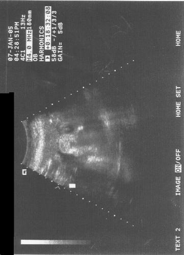 My Son  - If you look closely at this picture, you will see my son's face.  Notice the cheeks and what I believe as a slight smile.  I have never known so much joy.