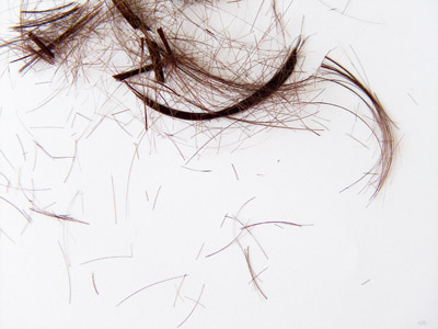 Hairs - Loss of hairs