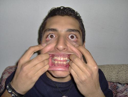 crazy friend - some times we do some ... works...