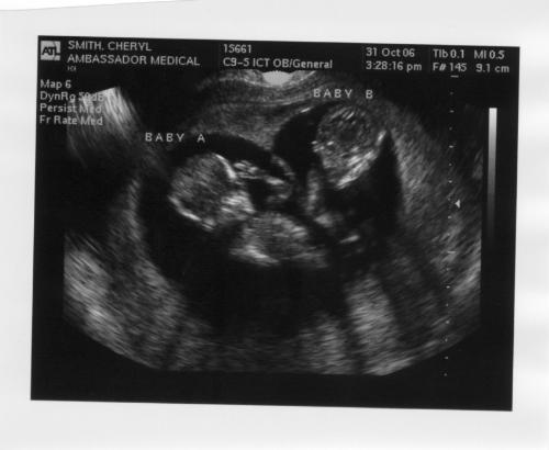 Twins - My best friend is having twins!!!