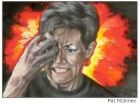 Migraine - photo of man holding his forehead with the look of excrutiating pain