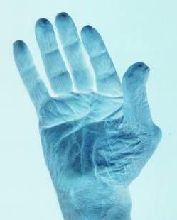 carpal tunnel syndrome - i finished MT and i learnd that CTS is the most common illness of people who always types and clicks the computer carpal tunnel syndrome - i finished MT and i learnd that CTS is the most common illness of people who always types and clicks the computer