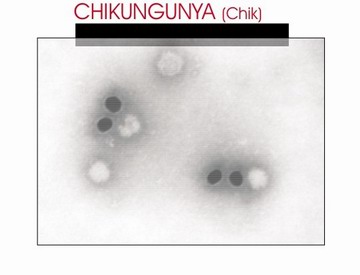 CHICKUNGUNYA FEVER' - CHIGU1245