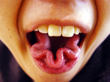 amazing,odd,like,love,friend,group,sour,tounge - amazing,odd,like,love,friend,group,sour,tounge