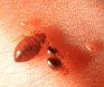Bed Bugs - Bed Bugs bite