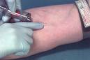 VENIPUNCTURE - BLOOD DRAW FOR HIV TEST