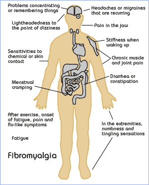 Dealing With Fibromyalgia - There are many areas in the body that experience difficulties when you suffer from Fibromyalgia. If you wish to learn more, you may visit: http://images.google.com/imgres?imgurl=http://www.mindbodyfocused.com/images/fibromyalgia.gif&imgrefurl=http://www.mindbodyfocused.com/body/fibromyalgia.php&h=371&w=300&sz=16&hl=en&start=1&tbnid=2V_ncdVYgf5piM:&tbnh=122&tbnw=99&prev=/images%3Fq%3Dfibromyalgia%26svnum%3D10%26hl%3Den%26lr%3D Dealing With Fibromyalgia - There are many areas in the body that experience difficulties when you suffer from Fibromyalgia. If you wish to learn more, you may visit: http://images.google.com/imgres?imgurl=http://www.mindbodyfocused.com/images/fibromyalgia.gif&imgrefurl=http://www.mindbodyfocused.com/body/fibromyalgia.php&h=371&w=300&sz=16&hl=en&start=1&tbnid=2V_ncdVYgf5piM:&tbnh=122&tbnw=99&prev=/images%3Fq%3Dfibromyalgia%26svnum%3D10%26hl%3Den%26lr%3D