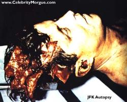 last picture of JFK taken after autopsy - last picture of JFK taken after autopsy