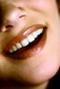 TEETHS - TEETHS