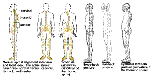 spinemen - spinemen