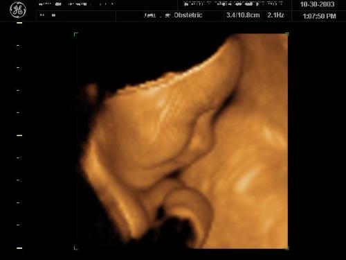 sonogram - sonogram