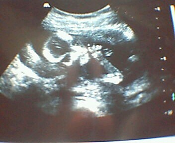sonogram - sonogram