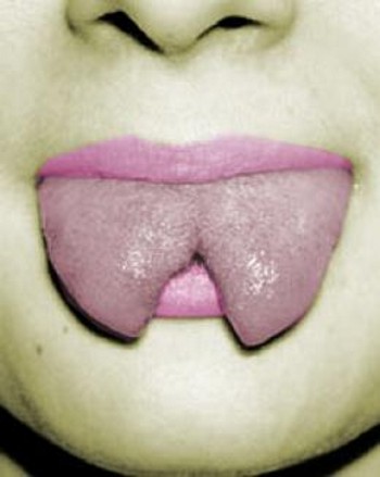 Tongue!!! - cut tongue
