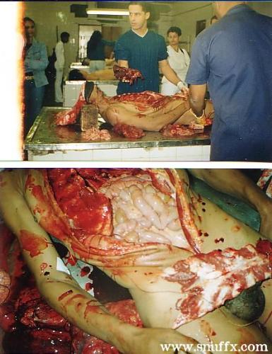 is it cruel?? -   
R u dare enough to see a Real Post mortem????? 
*
*
*
*
*
Are you Sure??? 
*
*
*
*
*
·*
*
*
*
*
·*
*
*
*
*
·*
*
*
*
*
··· Think Again?
·······*
*
* Still want to see the postmortem... 
*
*
*
*
*
*
*
*
*
*
*
*
*
*
*
* Then....
*
*
·*
*
*
*
*
·*
*
*
*
*
·*
*
*
*
*
·*
*
*
* Go ahead... 
  
*
*
*
*
*