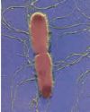 Organism causing typhoid fever - Salmonella typhoisa