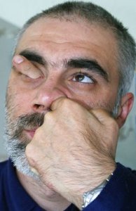 small nostrils  - finger in the nostrils