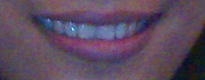 ma teeth:) - :)