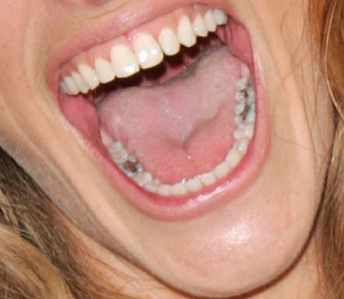 Julia Roberts - Julia Roberts has the mouth that seems a money box