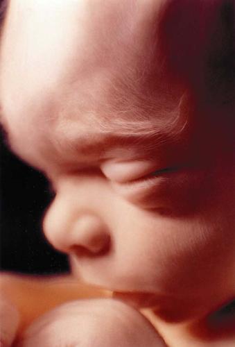 Unborn baby - Unborn Baby