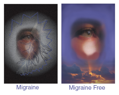 Migraine - Migraine