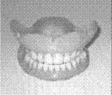 Dentures - Dentist