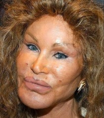 facelifts - This is what happens when you have too much money and too little self esteem