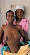 aids patient - A picture of a woman suffering from aids
