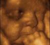 Baby in the Womb - Ultra Sound Image