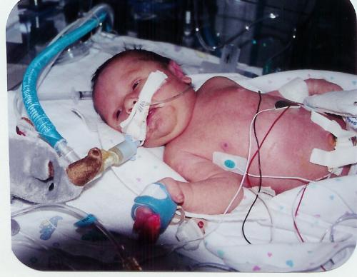 Baby In Neo Natal Intensive Care Unit - This is when my son was in a NICU...  I'll have to tell this story.