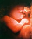 unborn child - unborn child at 5 mos. in the uterus