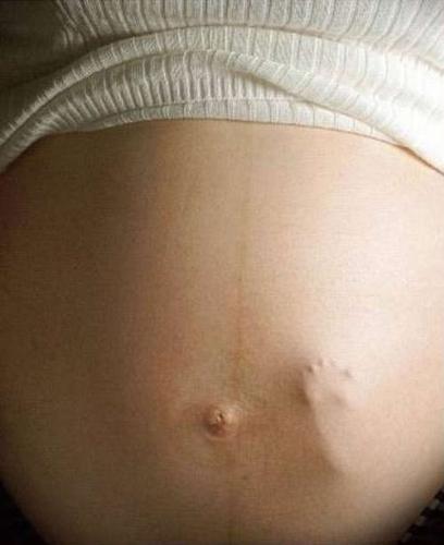 a pregnant lady - image