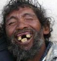 YOU LIKE MY SET!! - Teeth